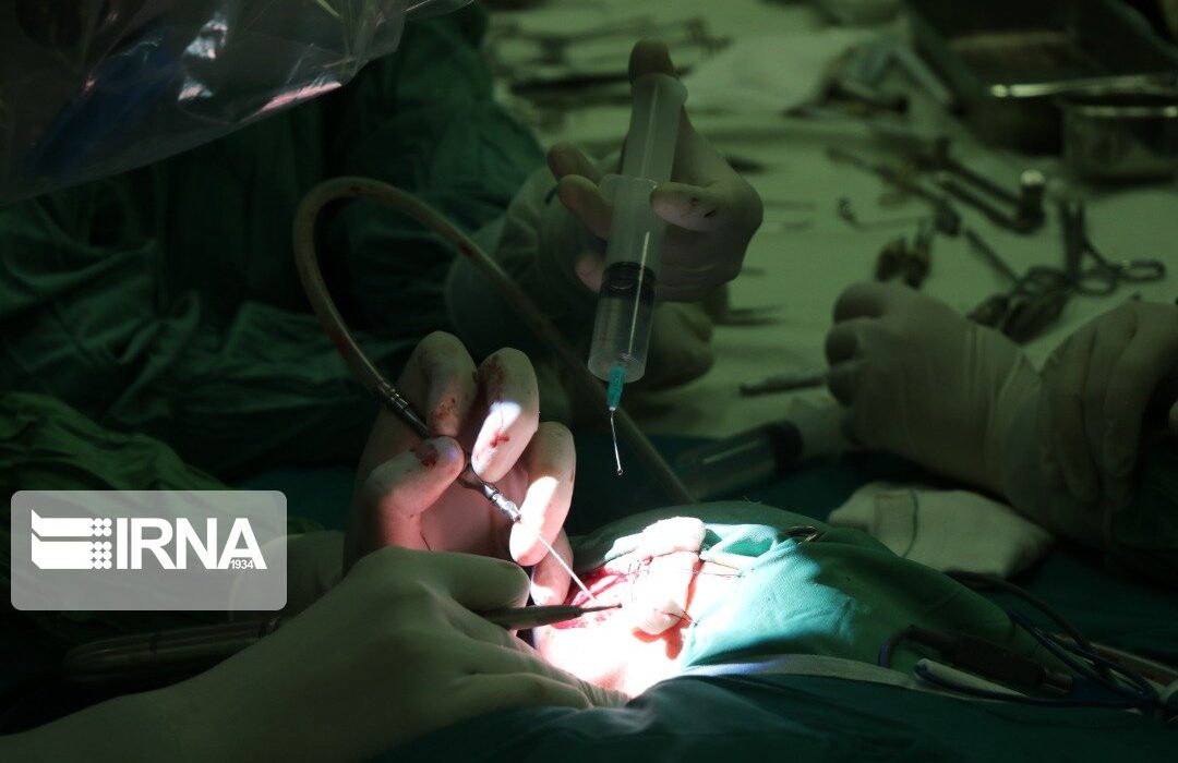 عمل جراحی “کیاری مالفورمیشن” برای نخستین بار در کردستان انجام شد