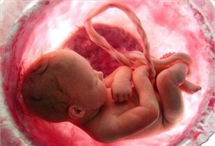 انتقال جنین آزمایشگاهی به رحم مادر با محصول “ایران‌ساخت” ممکن شد
