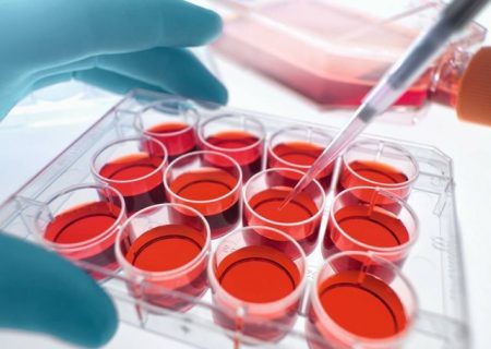 هزینه ذخیره‌سازی خون بندناف / حمایت “رویان” از بیماران نیازمندِ پیوند در پویش همدلی