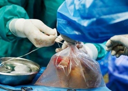 برگزاری دومین دوره جهانی رویارویی با خانواده‌های افراد مرگ مغزی