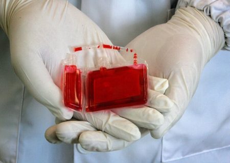 کاربردهای “خون بند ناف” در درمان بیماری های مهم