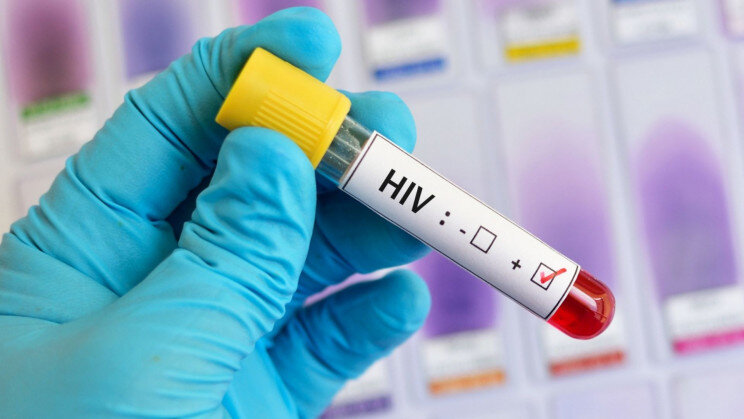 HIV چگونه منتقل می‌شود و راه‌های پیشگیری از آن چیست؟