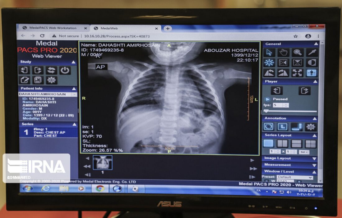 تجهیز بیمارستان های انتظامی به سیستم موبایل پکس