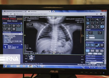 تجهیز بیمارستان های انتظامی به سیستم موبایل پکس