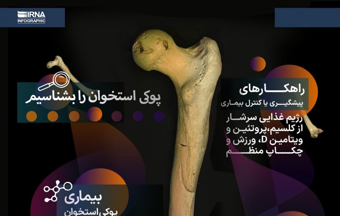 پوکی استخوان را بشناسیم