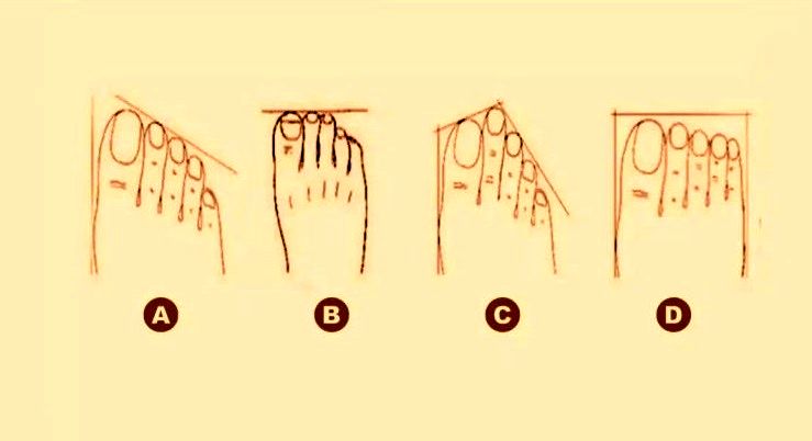تست شخصیت شناسی/ کدام شکل پا اسرار شخصیتی شما را فاش می‌کند؟